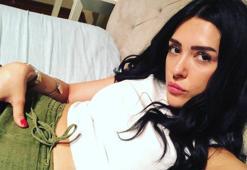 Ayşegül Doğan'dan canlı yayında estetik itirafı!