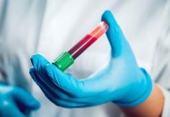 Ferritin değeri nedir? Ferritin yüksekliği veya düşüklüğünün nedeni nedir?