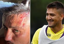 Fenerbahçe'nin yeni transfere Cengiz Ünder'e ilk antrenmanda şok