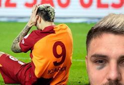 Fenerbahçe derbisinde yüzünü direğe çarpan Mauro Icardi'de kırık şüphesi! Süper Kupa'da oynayacak mı?