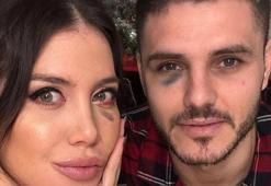 Wanda Nara, Icardi'den derbi izini sildi!