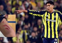 Edson Alvarez'in sakatlığında son durum! Stuttgart maçının ardından bacağının durumunu paylaşmıştı