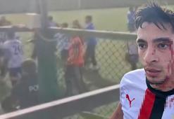 Saha, savaş alanına döndü! 3 futbolcu hastanelik oldu...