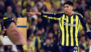 Edson Alvarez'in sakatlığında son durum! Stuttgart maçının ardından bacağının durumunu paylaşmıştı