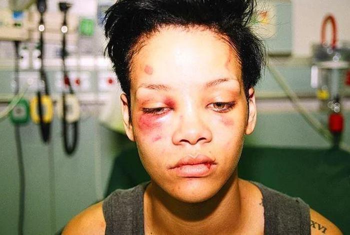 Chris Brown yine mi şiddet uyguladı