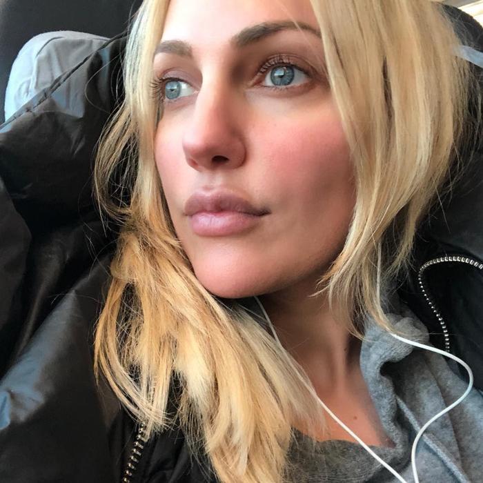 Estetik kurbanı oldu