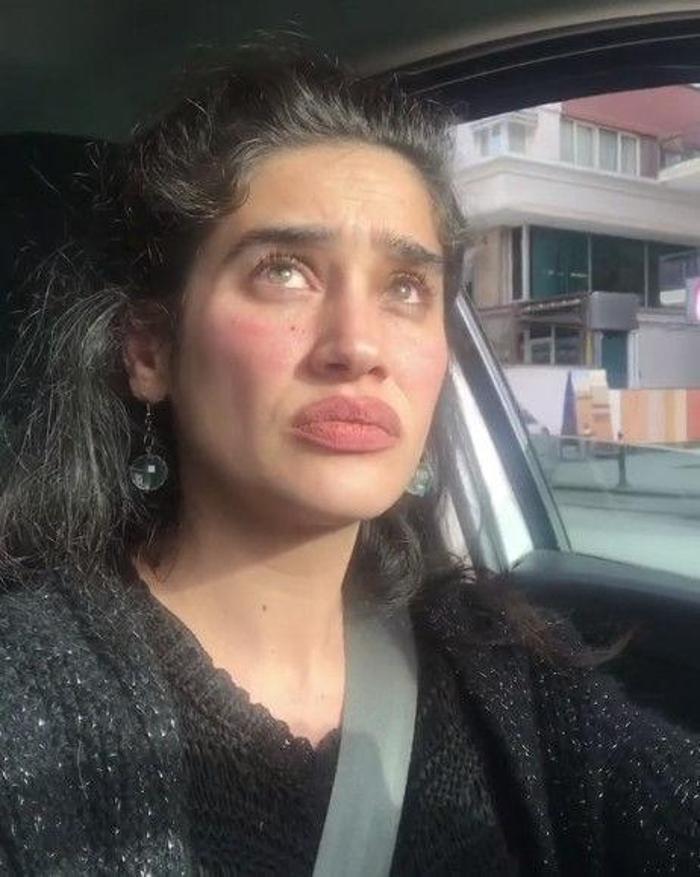Meltem Miraloğlunun son hali görenleri şaşkına çeviriyor