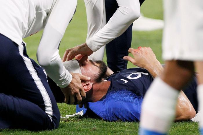 Olivier Giroud yürekleri ağızlara getirdi