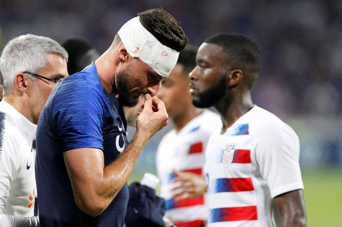 Olivier Giroud yürekleri ağızlara getirdi