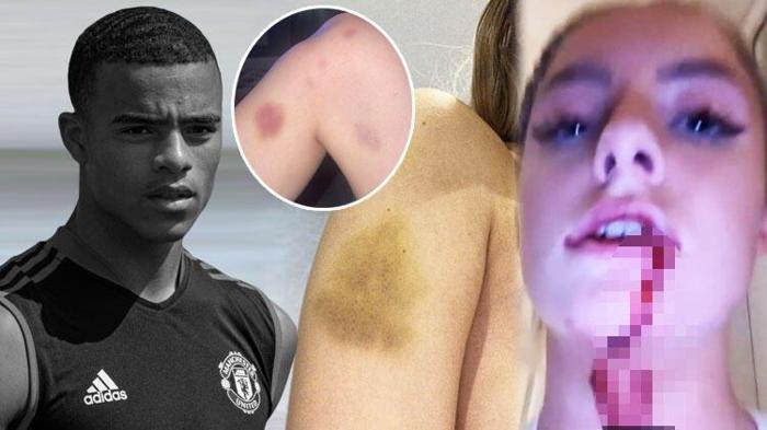 Harriet Robsona cinsel istismar ve şiddet uygulayan Mason Greenwood tutuklandı