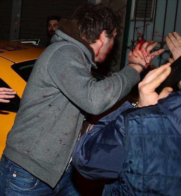 Oğuz Çetinin oğlunu dövdüler