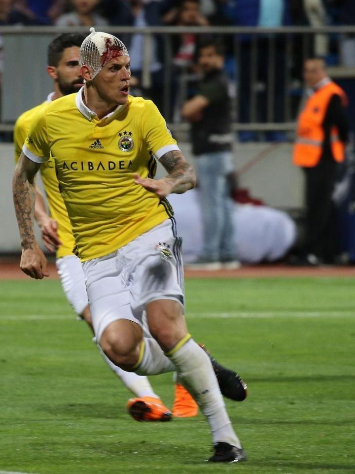 Fenerbahçede Skrtelin kafası yarıldı, kulüp fotoğraf paylaştı
