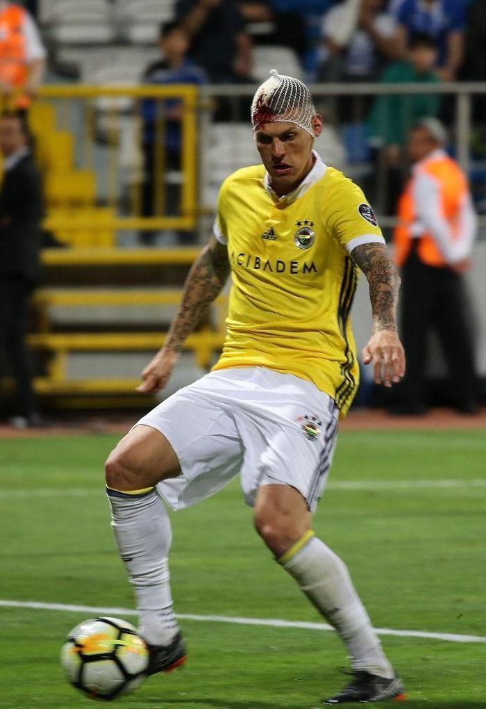 Fenerbahçede Skrtelin kafası yarıldı, kulüp fotoğraf paylaştı