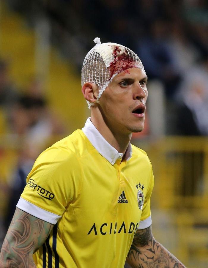 Fenerbahçede Skrtelin kafası yarıldı, kulüp fotoğraf paylaştı