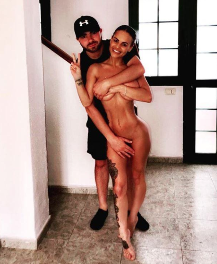 Chantelle Connellyin kalçasının izini gören şoke oluyor
