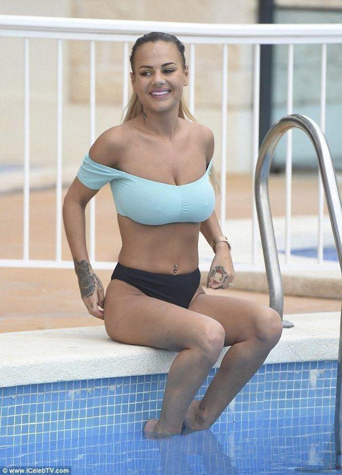 Chantelle Connellyin kalçasının izini gören şoke oluyor