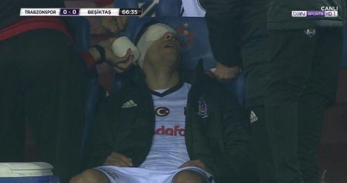 Trabzonspor-Beşiktaş maçından kareler