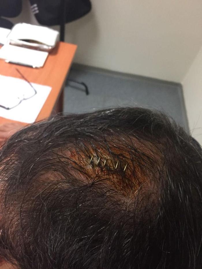 Şenol Güneşin kafasına dikiş atıldı ve hastaneye kaldırıldı