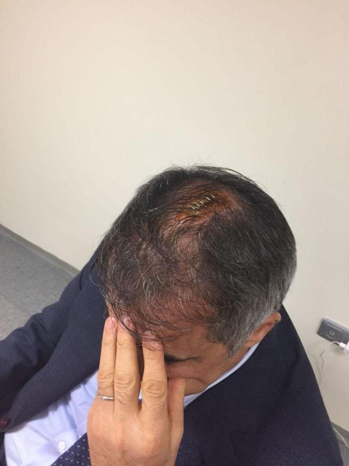Şenol Güneşin kafasına dikiş atıldı ve hastaneye kaldırıldı