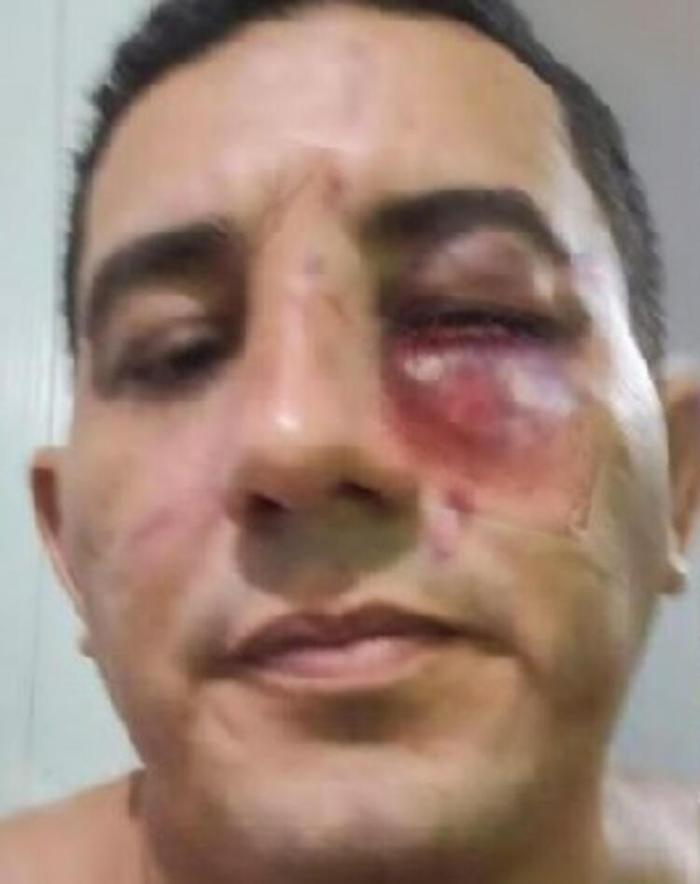 Brezilyada şok olay Politikacılar dövüştü, biletler 100 dolara satıldı
