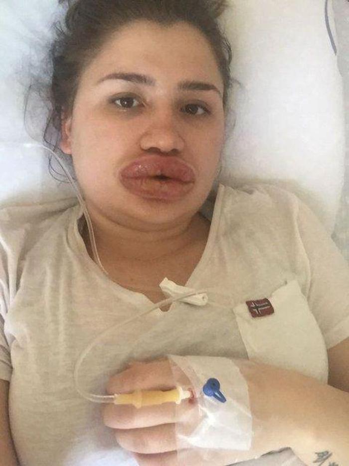 Merve hemşire son halini paylaştı