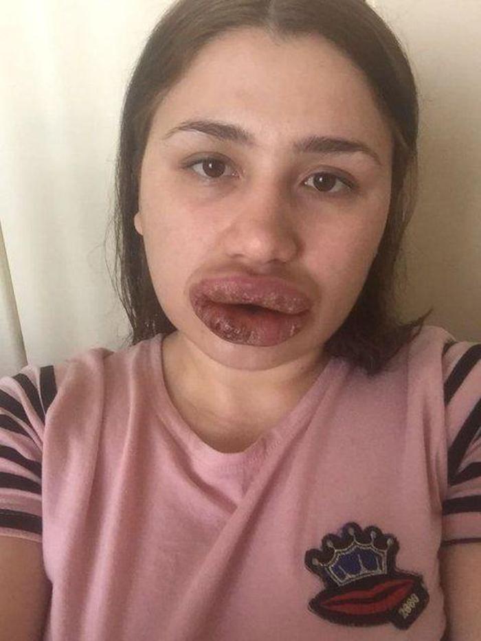Marilyn Monroeya benzemek isteyen adam herkesi hayrete düşürdü