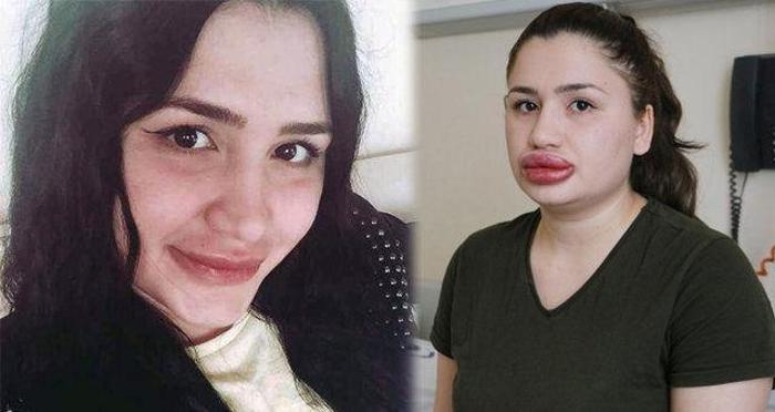 Marilyn Monroeya benzemek isteyen adam herkesi hayrete düşürdü