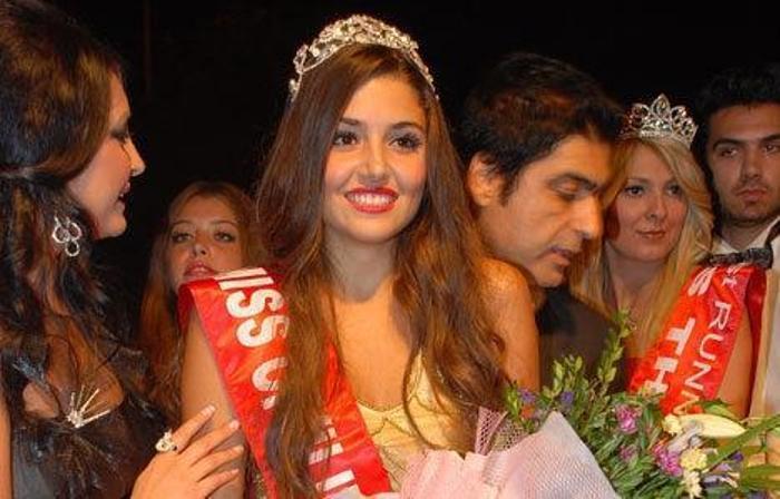 Hande Erçelin yüzüne ne oldu
