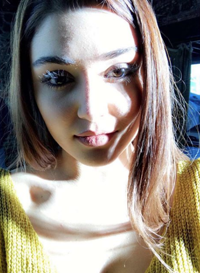 Hande Erçelin yüzüne ne oldu