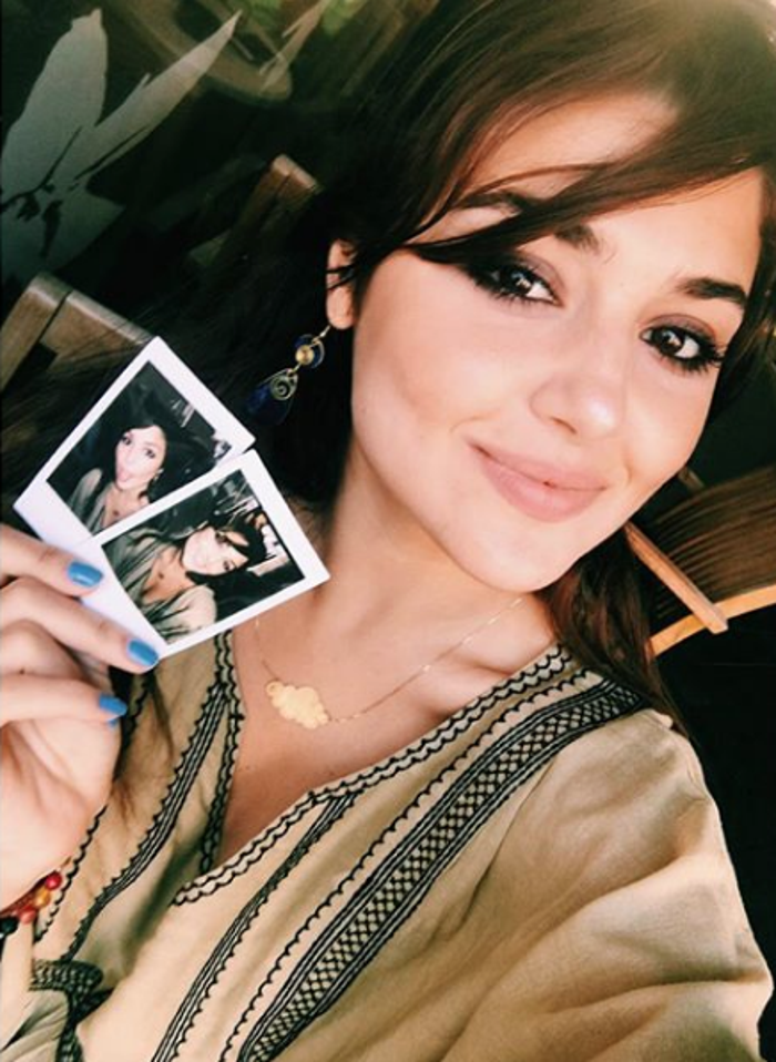 Hande Erçelin yüzüne ne oldu