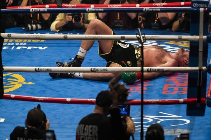 Deontay Wilderla berabere kalan Tyson Furynin yüzü savaş alanı gibi