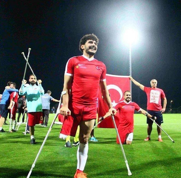 Ampute Milli Futbol Takımımız, Avrupa şampiyonu İşte kahramanların hikayeleri