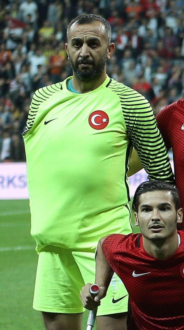 Ampute Milli Futbol Takımımız, Avrupa şampiyonu İşte kahramanların hikayeleri