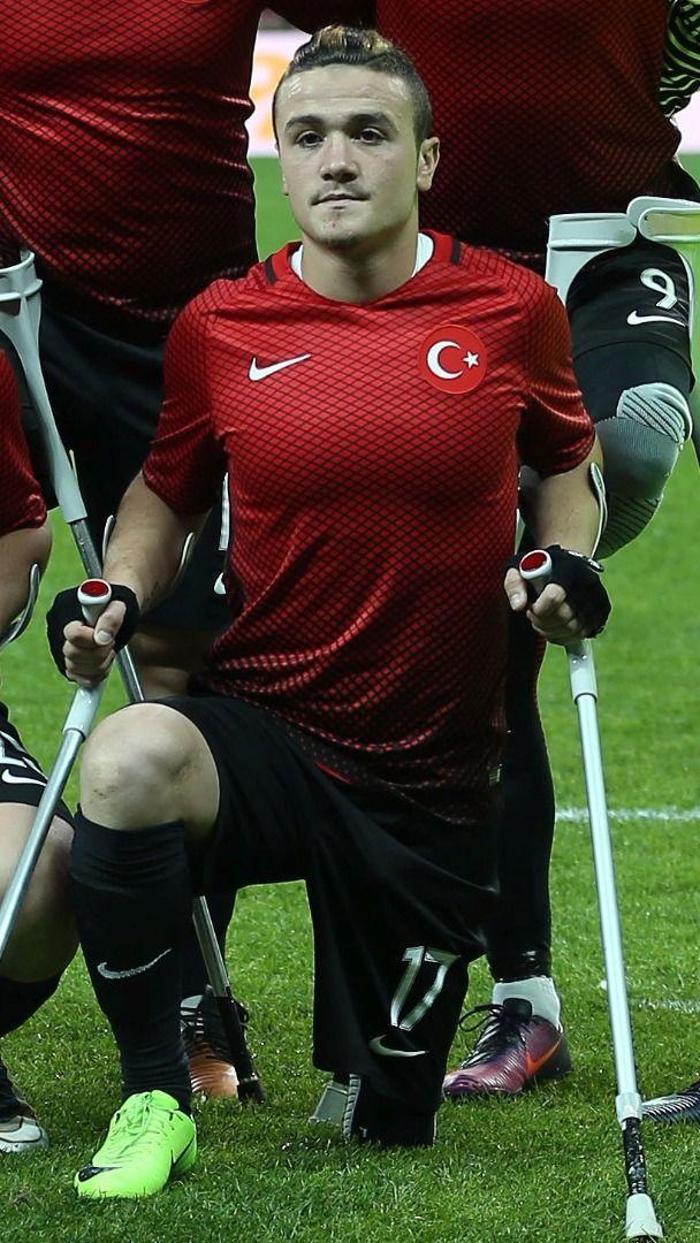Ampute Milli Futbol Takımımız, Avrupa şampiyonu İşte kahramanların hikayeleri