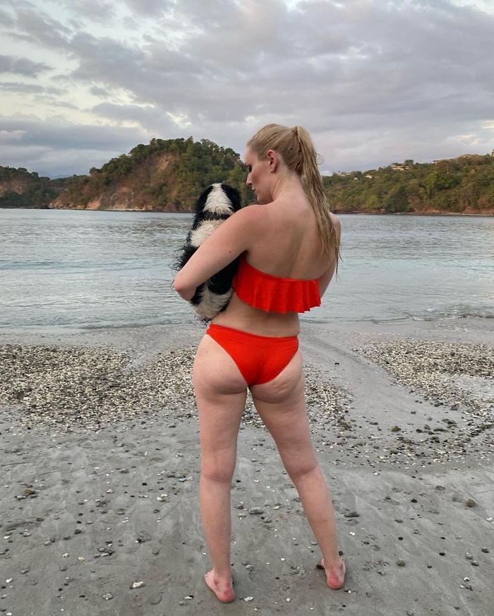 Lindsey Vonn selülitli fotoğrafını paylaşıp isyan etti