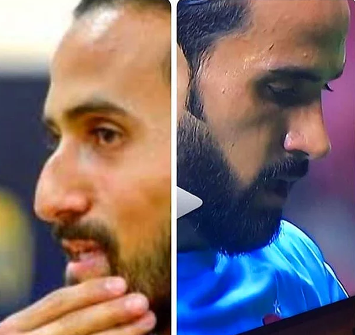Estetik yaptıran ve saç ektiren futbolcular