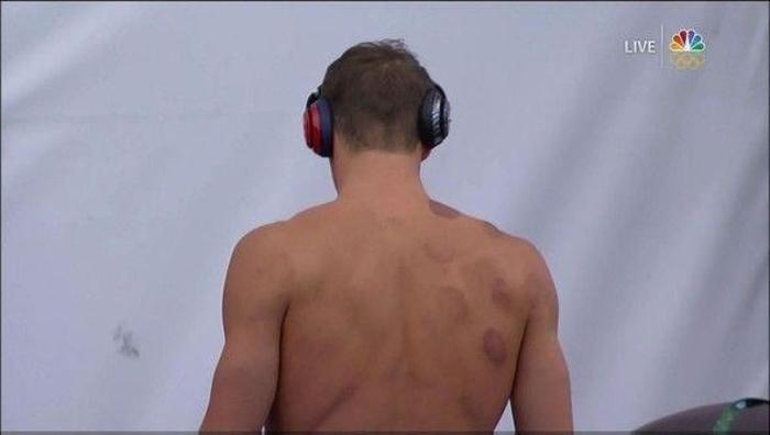 Phelpsteki izlerin sırrı belli oldu