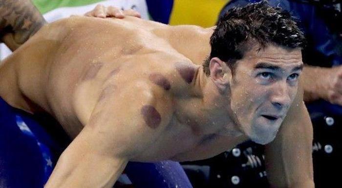 Phelpsteki izlerin sırrı belli oldu