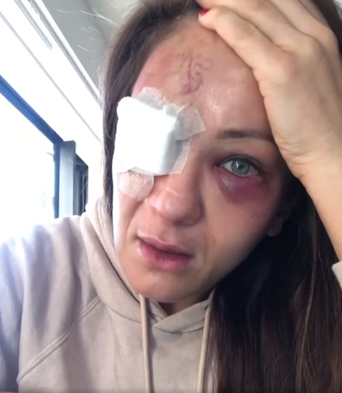 Karolina Kowalkiewiczin kariyeri sona erme tehlikesiyle karşı karşıya