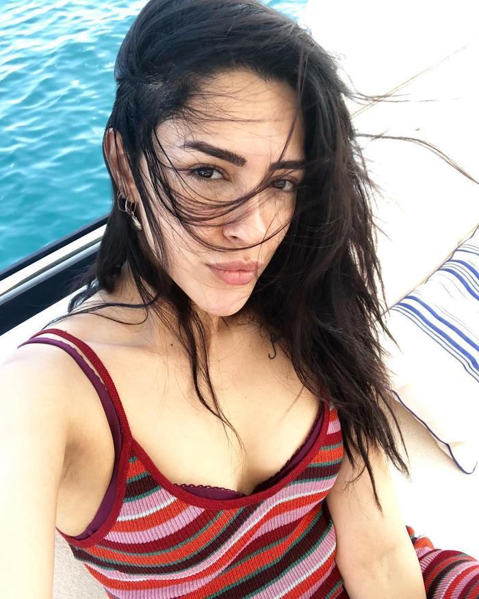 Ayşegül Doğandan canlı yayında estetik itirafı