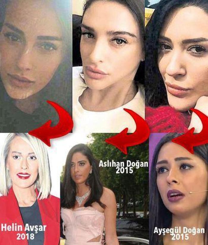 Ayşegül Doğandan canlı yayında estetik itirafı