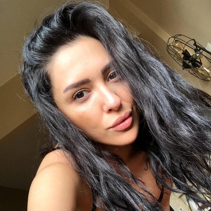 Ayşegül Doğandan canlı yayında estetik itirafı