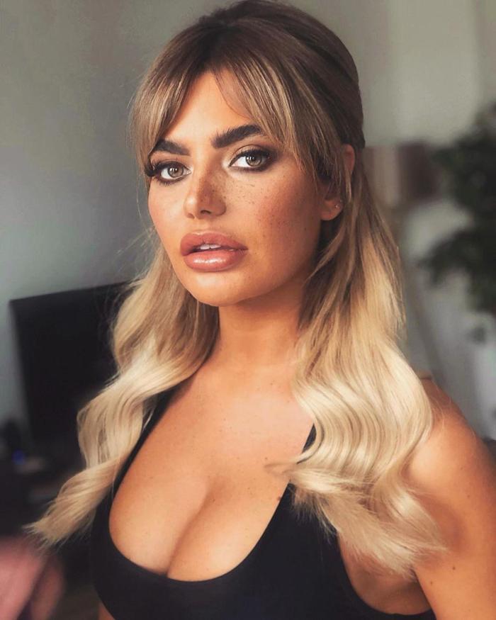Megan Barton Hanson: çirkin dediler çareyi estetik operasyonda buldum