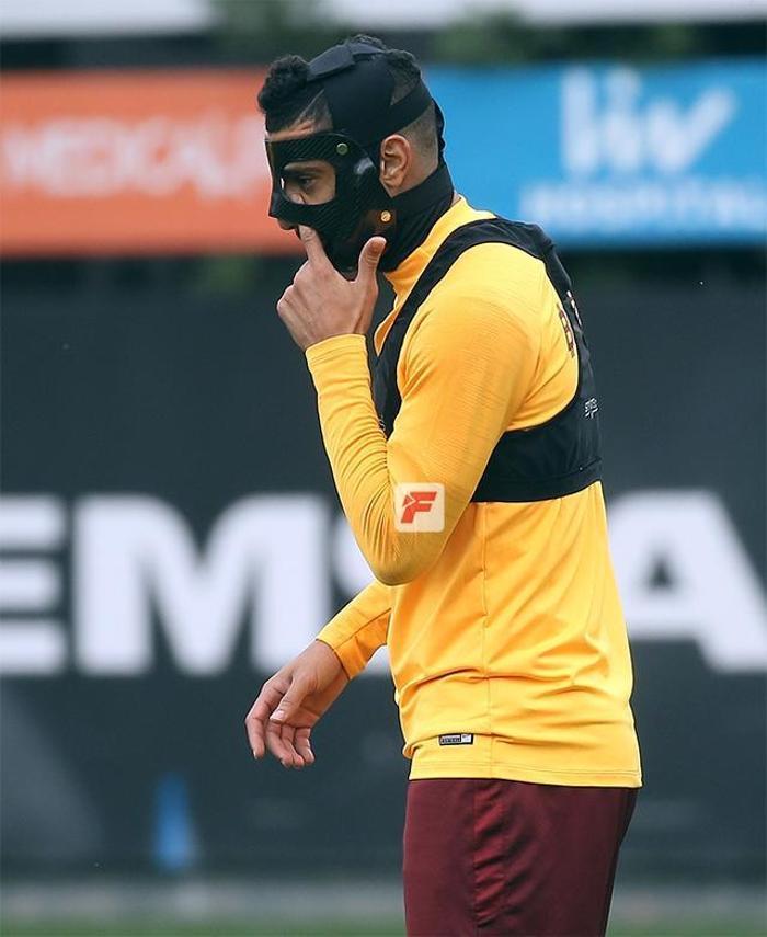 İşte Belhandanın Fenerbahçe derbisine çıkacağı maske