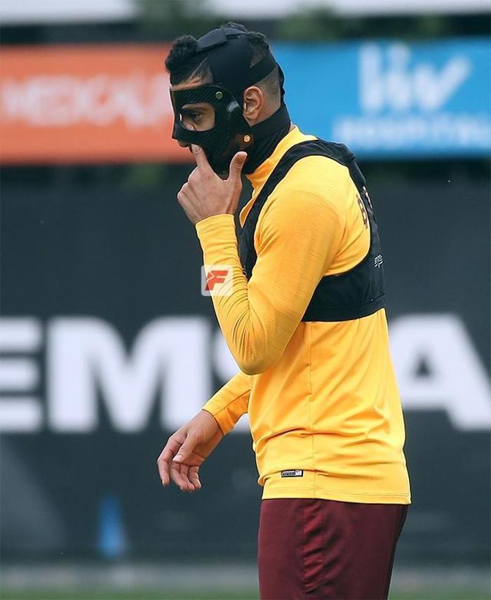 İşte Belhandanın Fenerbahçe derbisine çıkacağı maske