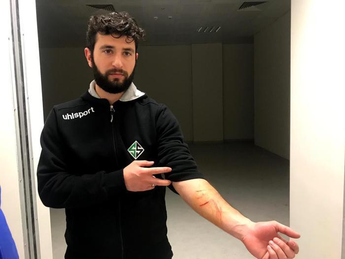 Amedspor - Sakaryaspor maçında şok iddia: Futbolcuları jiletle yaraladılar