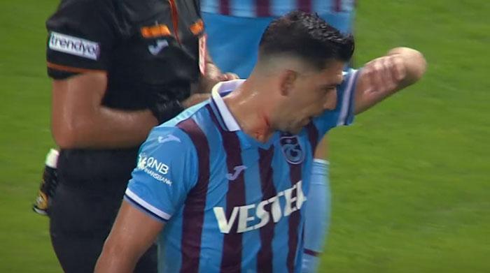 Trabzonspor-Beşiktaş maçında gerginlik Boğazı kanadı...