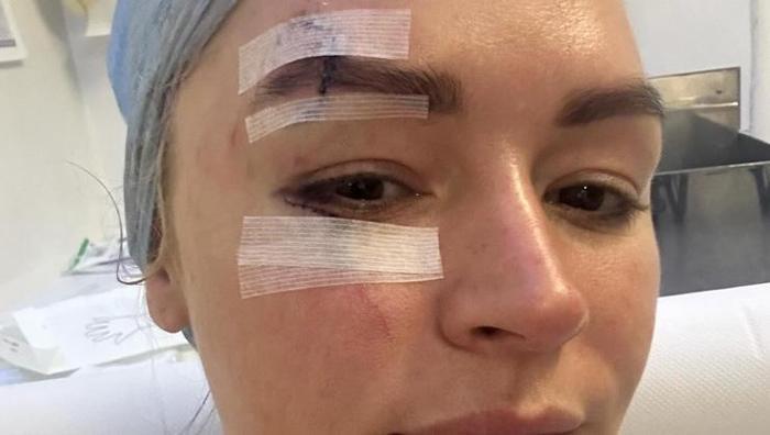 Ünlü sunucu Laura Woods ölümden döndü Yaşadıklarını anlattı: Şok geçirdim