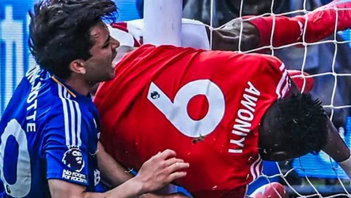 Horrible injury in the Premier League Official statement released