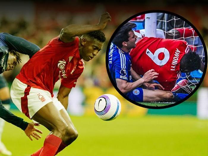 Horrible injury in the Premier League Official statement released